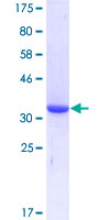 ab161339 on a 12.5% SDS-PAGE stained with Coomassie Blue.