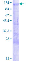 ab164592 on a 12.5% SDS-PAGE stained with Coomassie Blue.