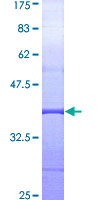 ab160009 on a 12.5% SDS-PAGE stained with Coomassie Blue.