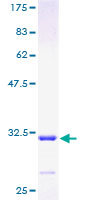 ab161066 on a 12.5% SDS-PAGE stained with Coomassie Blue.