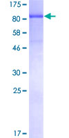 ab162292 on a 12.5% SDS-PAGE stained with Coomassie Blue.