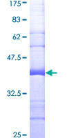 ab162293 on a 12.5% SDS-PAGE stained with Coomassie Blue.