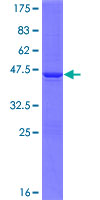 ab162963 on a 12.5% SDS-PAGE stained with Coomassie Blue.