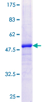 ab159939 on a 12.5% SDS-PAGE stained with Coomassie Blue.