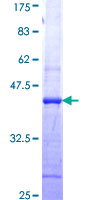 ab159940 on a 12.5% SDS-PAGE stained with Coomassie Blue.
