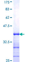 ab153018 on a 12.5% SDS-PAGE stained with Coomassie Blue.