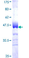 ab161379 on a 12.5% SDS-PAGE stained with Coomassie Blue.