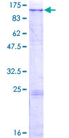 ab161603 on a 12.5% SDS-PAGE stained with Coomassie Blue.
