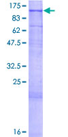 ab158854 on a 12.5% SDS-PAGE stained with Coomassie Blue.
