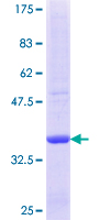 ab158855 on a 12.5% SDS-PAGE stained with Coomassie Blue.