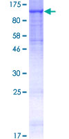 ab158857 on a 12.5% SDS-PAGE stained with Coomassie Blue.