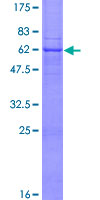 ab158884 on a 12.5% SDS-PAGE stained with Coomassie Blue.