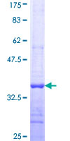ab158885 on a 12.5% SDS-PAGE stained with Coomassie Blue.