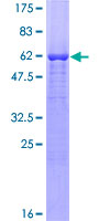 ab163781 on a 12.5% SDS-PAGE stained with Coomassie Blue.