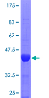 ab161072 on a 12.5% SDS-PAGE stained with Coomassie Blue.