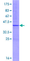 ab159216 on a 12.5% SDS-PAGE stained with Coomassie Blue.