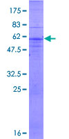 ab162930 on a 12.5% SDS-PAGE stained with Coomassie Blue.