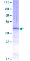 ab162931 on a 12.5% SDS-PAGE stained with Coomassie Blue.