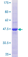 ab162472 on a 12.5% SDS-PAGE stained with Coomassie Blue.
