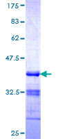 ab162473 on a 12.5% SDS-PAGE stained with Coomassie Blue.