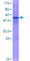ab165061 on a 12.5% SDS-PAGE stained with Coomassie Blue.