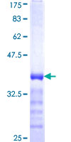 ab165062 on a 12.5% SDS-PAGE stained with Coomassie Blue.