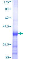 ab163594 on a 12.5% SDS-PAGE stained with Coomassie Blue.