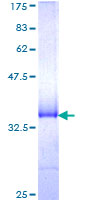 ab162820 on a 12.5% SDS-PAGE stained with Coomassie Blue.