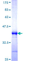 ab160935 on a 12.5% SDS-PAGE stained with Coomassie Blue.