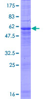 ab165955 on a 12.5% SDS-PAGE stained with Coomassie Blue.