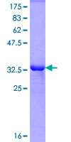 ab165956 on a 12.5% SDS-PAGE stained with Coomassie Blue.