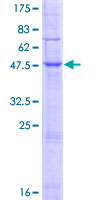 ab164928 on a 12.5% SDS-PAGE stained with Coomassie Blue.