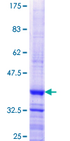ab164929 on a 12.5% SDS-PAGE stained with Coomassie Blue.