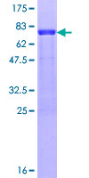 ab163921 on a 12.5% SDS-PAGE stained with Coomassie Blue.