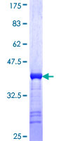 ab163922 on a 12.5% SDS-PAGE stained with Coomassie Blue.