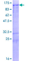 ab158356 on a 12.5% SDS-PAGE stained with Coomassie Blue.