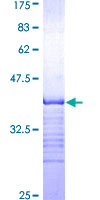 ab158357 on a 12.5% SDS-PAGE stained with Coomassie Blue.