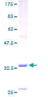 ab163650 on a 12.5% SDS-PAGE stained with Coomassie Blue.