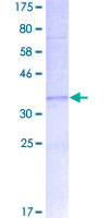 ab164924 on a 12.5% SDS-PAGE stained with Coomassie Blue.