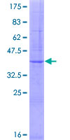 ab164437 on a 12.5% SDS-PAGE stained with Coomassie Blue.