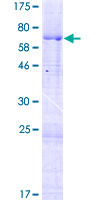 ab164883 on a 12.5% SDS-PAGE stained with Coomassie Blue.
