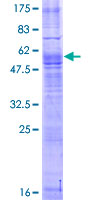 ab158861 on a 12.5% SDS-PAGE stained with Coomassie Blue.