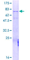 ab159246 on a 12.5% SDS-PAGE stained with Coomassie Blue.