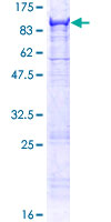 ab161136 on a 12.5% SDS-PAGE stained with Coomassie Blue.