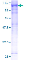 ab164698 on a 12.5% SDS-PAGE stained with Coomassie Blue.