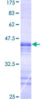 ab164699 on a 12.5% SDS-PAGE stained with Coomassie Blue.