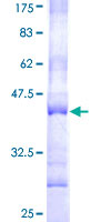 ab158862 on a 12.5% SDS-PAGE stained with Coomassie Blue.