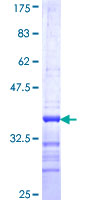ab158863 on a 12.5% SDS-PAGE stained with Coomassie Blue.