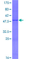ab164770 on a 12.5% SDS-PAGE stained with Coomassie Blue.