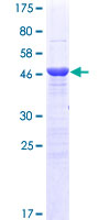 ab163214 on a 12.5% SDS-PAGE stained with Coomassie Blue.